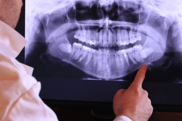Best Urgent Dental Care in Desert Aire, WA