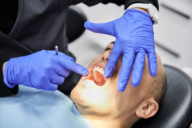 Best Emergency Tooth Extraction in Desert Aire, WA